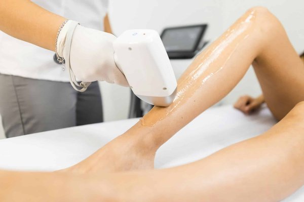Epilation à Forbach : combien coûte l'intervention d'un spécialiste ?